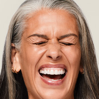 arrugas estáticas vs arrugas dinámicas