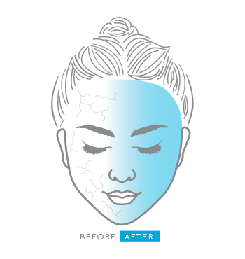 Illustration of Mary Kay Clinical Solutions HA + Ceramide Hydrator before and after showing improvement in hydration