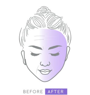 Illustration of Mary Kay Clinical Solutions C + Resveratrol Line Reducer before and after showing reduction of visible wrinkles