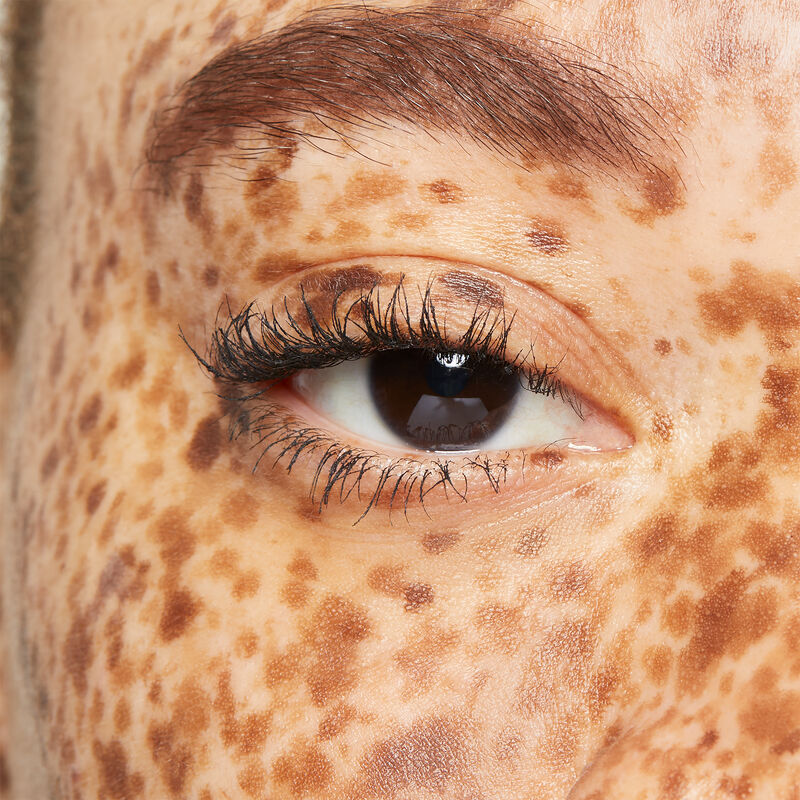 Close up of heavily freckled model&rsquo;s eye area before using the limited-edition Mary Kay Brow Kit&nbsp;