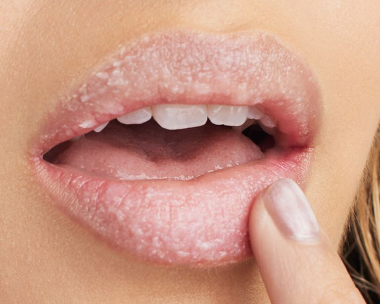 Mujer exfoli&aacute;ndose los labios